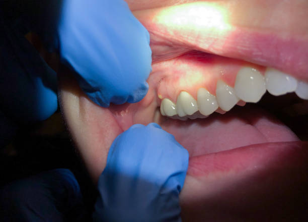Best Emergency Root Canal Treatment in Iona, ID
