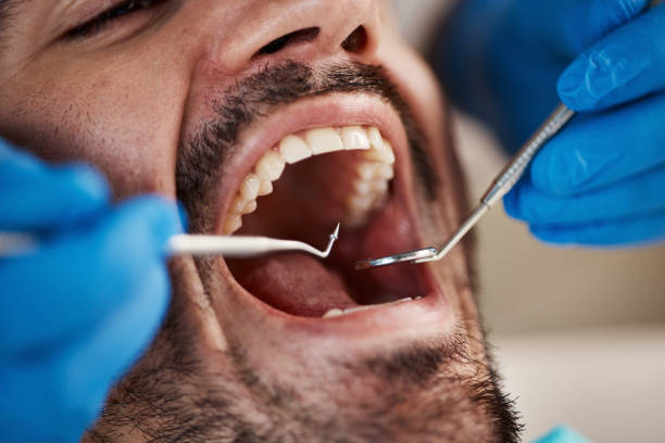 Best Urgent Dental Care for Toothache in Iona, ID